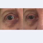 eye wrinkle filler night 15ml